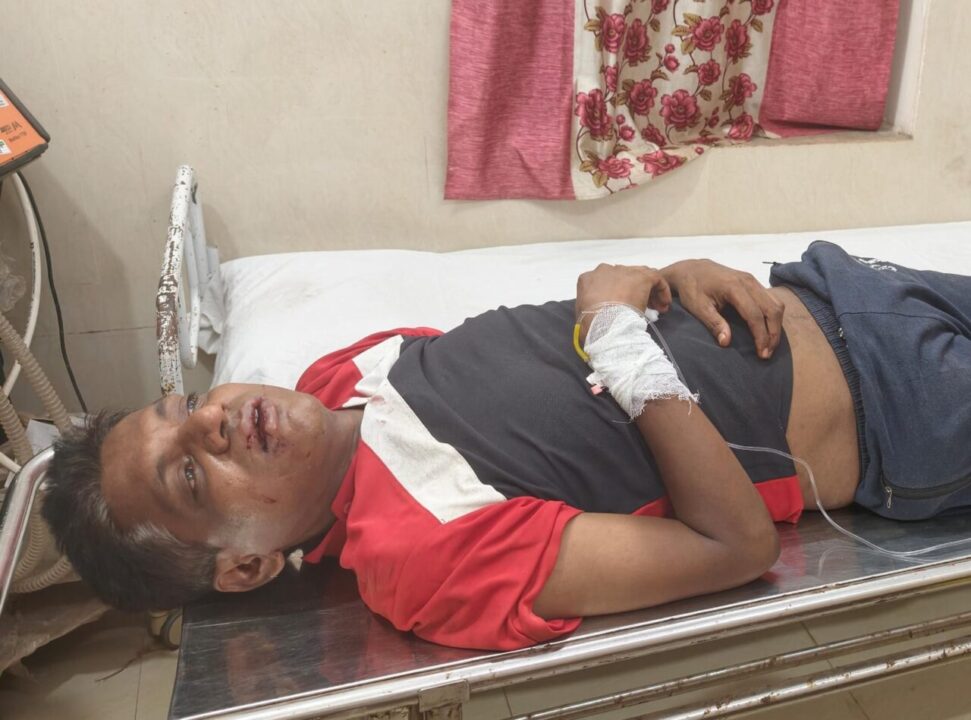 भरधाव वेगाने येणाऱ्या डंपरची मोटरसायकलला धडक : मोटरसायकलस्वार जखमी